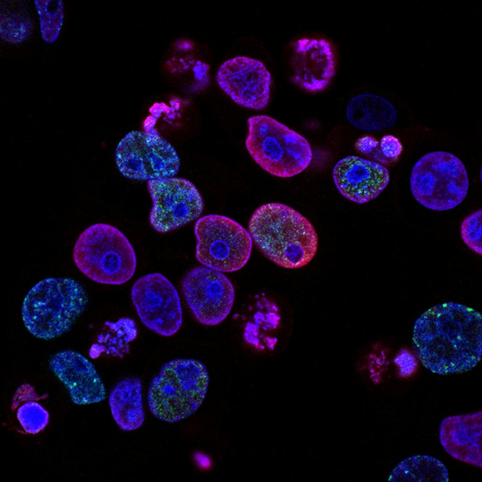 Microscopic view of fluorescent stem cells used as the Stem Cell History homepage hero